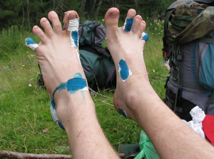 Мозоли в походе